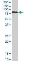 Anti-BRD3 Mouse Monoclonal Antibody [clone: 6C10]