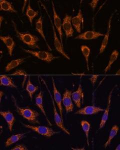 Immunofluorescence analysis of L929 cells using Anti-CCDC6 Antibody (A308478) at a dilution of 1:100. DAPI was used to stain the cell nuclei (blue).