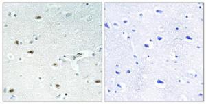 Immunohistochemical analysis of paraffin-embedded human brain tissue using Anti-Retinoblastoma Antibody. The right hand panel represents a negative control, where the Antibody was pre-incubated with the immunising peptide