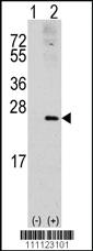 Anti-ACVR2B Rabbit Polyclonal Antibody