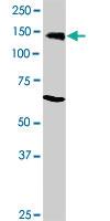 Anti-RB1 Mouse Monoclonal Antibody [clone: 3C11]