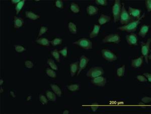 Anti-KPTN Mouse Monoclonal Antibody [clone: 1C7]