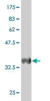 Anti-CST6 Mouse Polyclonal Antibody