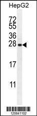 Anti-IRGM Rabbit Polyclonal Antibody (AP (Alkaline Phosphatase))