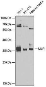 Western blot analysis of extracts of various cell lines, using Anti-Myeloid leukemia factor 1 Antibody (A10262) at 1:1,000 dilution The secondary antibody was Goat Anti-Rabbit IgG H&L Antibody (HRP) at 1:10,000 dilution Lysates/proteins were present at 25 µg per lane