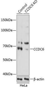 Western blot analysis of extracts from normal (control) and CCDC6 knockout (KO) HeLa cells, using Anti-CCDC6 Antibody (A308479) at 1:1,000 dilution. The secondary antibody was Goat Anti-Rabbit IgG H&L Antibody (HRP) at 1:10,000 dilution.