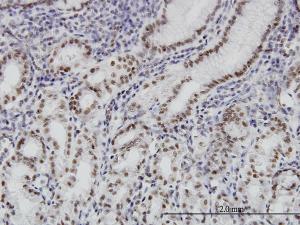 Anti-BRD3 Mouse Monoclonal Antibody [clone: 6C10]