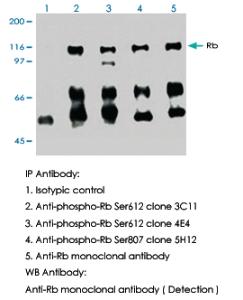 Anti-RB1 Mouse Monoclonal Antibody [clone: 3C11]