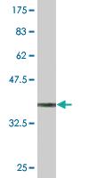 Anti-STK3 Mouse Monoclonal Antibody [clone: 1B3]