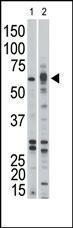 Anti-ACVR1B Rabbit Polyclonal Antibody (FITC (Fluorescein Isothiocyanate))