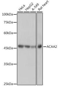 Anti-ACAA2 antibody