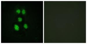 Anti-VAV1 antibody