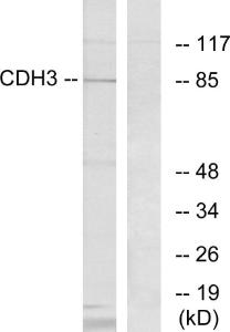 Western blot analysis of lysates from K562 cells using Anti-CDH3 Antibody The right hand lane represents a negative control, where the antibody is blocked by the immunising peptide