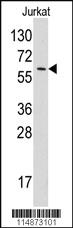 Anti-YARS Rabbit Polyclonal Antibody