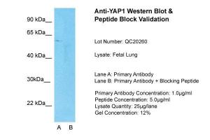 Anti-YAP1 Rabbit Polyclonal Antibody