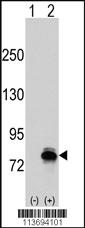 Anti-CDH6 Rabbit Polyclonal Antibody