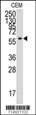 Anti-YARS Rabbit Polyclonal Antibody