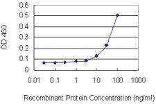 Anti-OLFM1 Mouse Monoclonal Antibody [clone: 2E9-1A2]