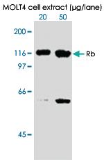 Anti-RB1 Mouse Monoclonal Antibody [clone: 3C11]