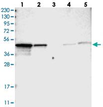 Anti-NDRG3 Rabbit Polyclonal Antibody