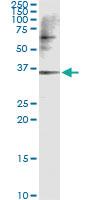 Anti-CAMK1D Antibody Pair