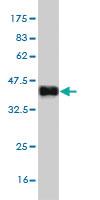 Anti-CST6 Mouse Monoclonal Antibody [clone: 2H8]