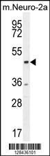 Anti-CTBP1 Rabbit Polyclonal Antibody