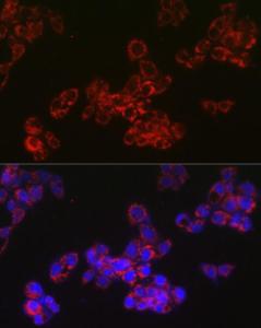 Anti-ACAA2 antibody