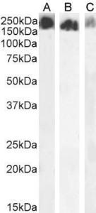 Anti-SCRIB Antibody (A121159) (2 µg/ml) staining of HeLa (A), HepG2 (B) and U2OS (C) cell lysate (35 µg protein in RIPA buffer). Detected by chemiluminescence