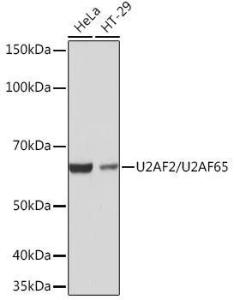 Anti-U2AF65 Rabbit Monoclonal Antibody [clone: ARC1029]