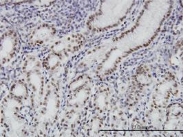 Anti-BRD3 Mouse Monoclonal Antibody [clone: 6C10]