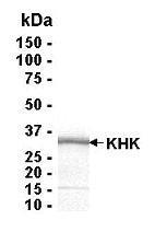 SDS PAGE: Analysis of KHK Recombinant Protein. 4-20% SDS gradient gel. Coomassie blue staining.