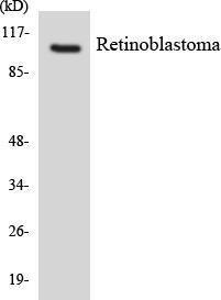 Anti-Retinoblastoma antibody