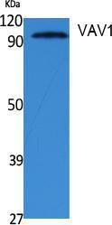 Anti-VAV1 antibody