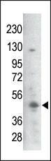 Anti-GSK3B Rabbit Polyclonal Antibody (AP (Alkaline Phosphatase))