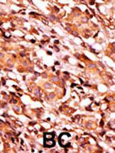 Anti-BAD Rabbit Polyclonal Antibody (FITC (Fluorescein))