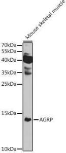 Western blot analysis of extracts of Mouse skeletal muscle, using Anti-AGRP Antibody (A10271) at 1:1000 dilution