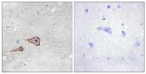 Immunohistochemical analysis of paraffin-embedded human brain tissue using Anti-CDH3 Antibody The right hand panel represents a negative control, where the antibody was pre-incubated with the immunising peptide