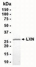 SDS PAGE: Analysis of LXN Recombinant Protein. 4-20% SDS gradient gel. Coomassie blue staining.