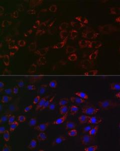 Anti-ACAA2 antibody