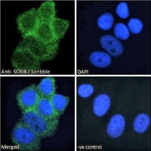 Anti-SCRIB Antibody (A121159) - Immunofluorescence analysis of paraformaldehyde fixed MCF7 cells, permeabilized with 0.15% Triton