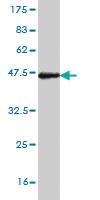 Anti-NKX3-1 Mouse Monoclonal Antibody [clone: 1C7]