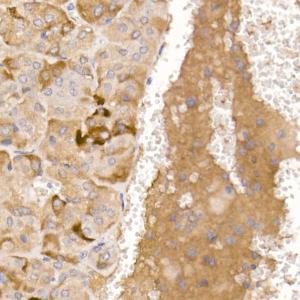 Immunohistochemistry analysis of paraffin-embedded mouse adrenal gland using Anti-AGRP Antibody (A10271) at a dilution of 1:50 (40x lens). Perform high pressure antigen retrieval with 10 mM citrate buffer pH 6.0 before commencing with IHC staining protocol