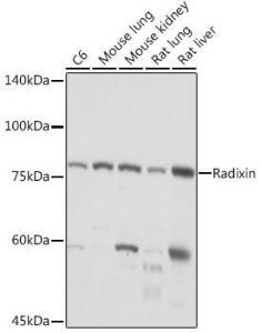 Western blot analysis of extracts of various cell lines, using Anti-Radixin / RDX Antibody [ARC2277] (A308483) at 1:1,000 dilution. The secondary antibody was Goat Anti-Rabbit IgG H&L Antibody (HRP) at 1:10,000 dilution.