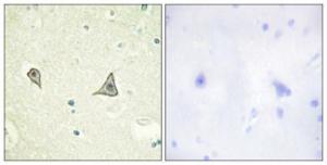 Immunohistochemical analysis of paraffin-embedded human brain tissue using Anti-M-CSF Receptor Antibody The right hand panel represents a negative control, where the antibody was pre-incubated with the immunising peptide