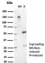 SDS-PAGE analysis of Anti-EpCAM Antibody [EGP40/7025R] under non-reduced and reduced conditions; showing intact IgG and intact heavy and light chains, respectively. SDS-PAGE analysis confirms the integrity and purity of the antibody.