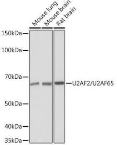 Anti-U2AF65 Rabbit Monoclonal Antibody [clone: ARC1029]