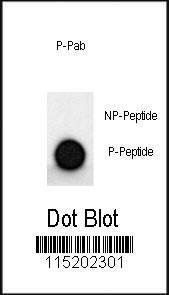 Anti-MAP2 Rabbit Polyclonal Antibody (AP (Alkaline Phosphatase))