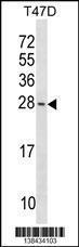 Anti-BAX Rabbit Polyclonal Antibody (HRP (Horseradish Peroxidase))