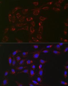 Anti-ACAA2 antibody